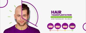 عيادة آريان لزراعة الشعر – شيراز